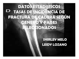 DATOS ESTADISTICOS
  TASAS DE INCIDENCIA DE
FRACTURA DE CADERA SEGÚN
     GENERO Y PAISES
     SELECCIONADOS

             SHIRLEY MELO
             LEIDY LOZANO
 