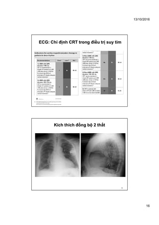 13/10/2016
16
ECG: Chỉ định CRT trong điều trị suy tim
Kích thích đồng bộ 2 thất
32
 