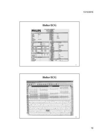 13/10/2016
19
Holter ECG
37
Holter ECG
38
 