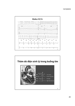13/10/2016
20
Holter ECG
39
Thăm dò điện sinh lý trong buồng tim
40
 