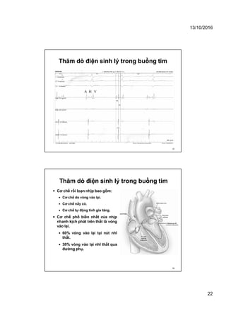 13/10/2016
22
Thăm dò điện sinh lý trong buồng tim
VA H
43
Thăm dò điện sinh lý trong buồng tim
 Cơ chế rối loạn nhịp bao gồm:
 Cơ chế do vòng vào lại.
 Cơ chế nẩy cò.
 Cơ chế tự động tính gia tăng.
 Cơ chế phổ biến nhất của nhịp
nhanh kịch phát trên thất là vòng
vào lại.
 60% vòng vào lại tại nút nhĩ
thất.
 30% vòng vào lại nhĩ thất qua
đường phụ.
44
 