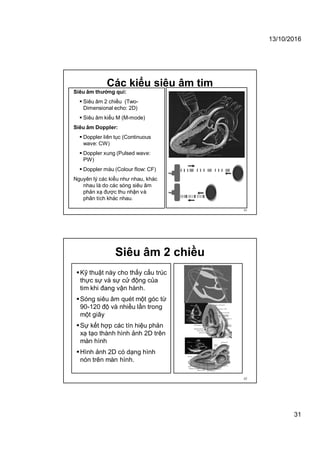 13/10/2016
31
Các kiểu siêu âm tim
61
Siêu âm thường qui:
 Siêu âm 2 chiều (Two-
Dimensional echo: 2D)
 Siêu âm kiểu M (M-mode)
Siêu âm Doppler:
 Doppler liên tục (Continuous
wave: CW)
 Doppler xung (Pulsed wave:
PW)
 Doppler màu (Colour flow: CF)
Nguyên lý các kiểu như nhau, khác
nhau là do các sóng siêu âm
phản xạ được thu nhận và
phân tích khác nhau.
Siêu âm 2 chiều
Kỹ thuật này cho thấy cấu trúc
thực sự và sự cử động của
tim khi đang vận hành.
Sóng siêu âm quét một góc từ
90-120 độ và nhiều lần trong
một giây
Sự kết hợp các tín hiệu phản
xạ tạo thành hình ảnh 2D trên
màn hình
Hình ảnh 2D có dạng hình
nón trên màn hình.
62
 
