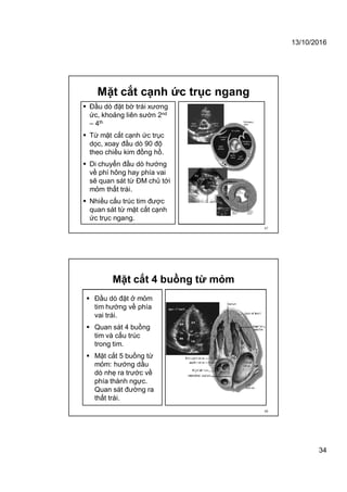 13/10/2016
34
Mặt cắt cạnh ức trục ngang
 Đầu dò đặt bờ trái xương
ức, khoảng liên sườn 2nd
– 4th
 Từ mặt cắt cạnh ức trục
dọc, xoay đầu dò 90 độ
theo chiều kim đồng hồ.
 Di chuyển đầu dò hướng
về phí hông hay phía vai
sẽ quan sát từ ĐM chủ tới
mỏm thất trái.
 Nhiều cấu trúc tim được
quan sát từ mặt cắt cạnh
ức trục ngang.
67
Mặt cắt 4 buồng từ mỏm
 Đầu dò đặt ở mỏm
tim hướng về phía
vai trái.
 Quan sát 4 buồng
tim và cấu trúc
trong tim.
 Mặt cắt 5 buồng từ
mỏm: hướng dầu
dò nhẹ ra trước về
phía thành ngực.
Quan sát đường ra
thất trái.
68
 