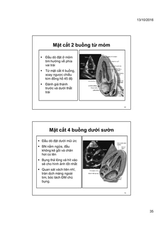 13/10/2016
35
Mặt cắt 2 buồng từ mỏm
 Đầu dò đặt ở mỏm
tim hướng về phía
vai trái
 Từ mặt cắt 4 buồng,
xoay ngược chiều
kim đồng hồ 45 độ
 Đánh giá thành
trước và dưới thất
trái
69
Mặt cắt 4 buồng dưới sườn
 Đầu dò đặt dưới mũi ức
 BN nằm ngửa, đầu
không kê gối và chân
hơi co lên
 Bụng thả lỏng và hít vào
sẽ cho hình ảnh tốt nhất
 Quan sát vách liên nhĩ,
tràn dịch màng ngoài
tim, bóc tách ĐM chủ
bụng.
70
 