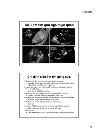 13/10/2016
38
Siêu âm tim qua ngã thực quản
75
Chỉ định siêu âm tim gắng sức
1. Đánh giá ban đầu hội chứng đau ngực hay tương đương:
 Khả năng tiền NF chẩn đoán bệnh mạch vàng trung bình, ECG không
thể giải thích hay BN không thể gắng sức
2. Triệu chứng nặng thêm: thông tim bất thường hay xét nghiệm hình ảnh
trước đó bất thường:
 Đánh gía lại BN điều trị nội khoa
3. Hội chứng đau ngực hay tương đương với kết quả XN trước đó:
 Hẹp MV trung bình (trên chụp MV hay CT mạch vành)
4. Đánh giá tiền phẫu không phải tim, tiền phẫu không cấp cứu nguy cơ cao
 Khả năng gắng sức kém (<4 mets, < 75 watts)
5. Đánh giá sau tái tưới máu mạch vành có triệu chứng:
 Đau ngực
6. Bệnh tim TMCB, đánh giá thiếu máu cục bộ hay khả năng sống còn:
 Bệnh mạch vành đã biết, ứng cử cho tái tưới máu
7. Hẹp van tim:
 Đánh giá hẹp van ĐM chủ, cung lượng tim thấp, sử dụng dobutamine
76
 