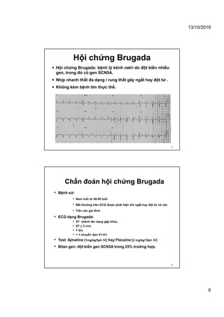 13/10/2016
6
Hội chứng Brugada
 Hội chứng Brugada: bệnh lý kênh natri do đột biến nhiều
gen, trong đó có gen SCN5A.
 Nhịp nhanh thất đa dạng / rung thất gây ngất hay đột tử .
 Không kèm bệnh tim thực thể.
11
Chẩn đoán hội chứng Brugada
• Bệnh sử:
• Nam tuổi từ 40-50 tuổi
• Bất thường trên ECG được phát hiện khi ngất hay đột tử vô căn
• Tiền căn gia đình
• ECG dạng Brugada:
• ST chênh lên dạng gập khúc,
• ST > 2 mm,
• T âm,
• > 1 chuyển đạo V1-V3
• Test Ajmaline (1mg/kg/5ph IV) hay Flecaine (2 mg/kg/10ph IV)
• Bilan gen: đột biến gen SCN5A trong 25% trường hợp.
12
 