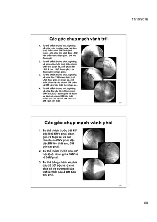 13/10/2016
60
Các góc chụp mạch vành trái
119
1. Tư thế chếch trước trái, nghiêng
về phía chân (spider view ) sẽ bộc
lộ rõ thân chính ĐMV trái (left
main) , chổ chia đôi LAD &lcx , ĐM
liên thất trước đoạn gần , ĐM mũ
đoạn gần.
2. Tư thế chếch trước phải, nghiêng
về phía chân bộc lộ rõ thân chính
ĐMV trái đoạn xa, chỗ phân đôi
LAD & Lcx , LAD đoạn gần, Lcx
đoạn gần và đoạn giữa.
3. Tư thế chếch trước phải, nghiêng
về phía đầu (TIMI view) bộc lộ rõ
LAD đoạn giữa và đoạn xa, chỗ
xuất phát của các nhánh ĐM chéo
và ĐM vách liên thất, Lcx đoạn xa .
4. Tư thế chếch trước trái, nghiêng
về phía đầu bộc lộ rõ thân chính
ĐMV trái, LAD đoạn giữa và đoạn
xa, tách rõ nhánh ĐM liên thất
trước với các nhánh ĐM chéo và
ĐM vách liên thất.
Các góc chụp mạch vành phải
120
1. Tư thế chếch trước trái 450
bộc lộ rõ ĐMV phải, đoạn
gần và đoạn xa, và các
nhánh của ĐMV phải, đặc
biệt ĐM liên thất sau, ĐM
bên sau phải.
2. Tư thế chếch trước phải 300
bộc lộ rõ đoạn giữa ĐMV và
lổ ĐMV phải.
3. Tư thế thẳng chếch về phía
đầu 20 -300 bộc lộ rõ chổ
chia đôi và đường đi của
ĐM liên thất sau & ĐM bên
sau phải.
 