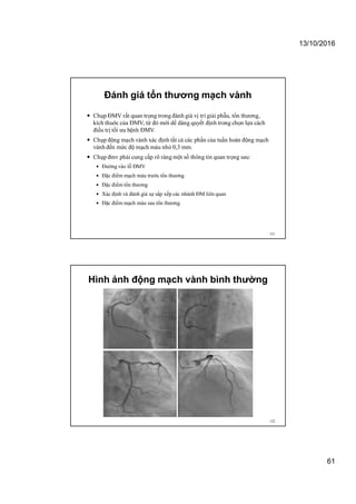 13/10/2016
61
Đánh giá tổn thương mạch vành
 Chụp ĐMV rất quan trọng trong đánh giá vị trí giải phẫu, tổn thương,
kích thuớc của ĐMV, từ đó mới dể dàng quyết định trong chọn lựa cách
điều trị tối ưu bệnh ĐMV.
 Chụp động mạch vành xác định tất cả các phần của tuần hoàn động mạch
vành đến mức độ mạch máu nhỏ 0,3 mm.
 Chụp đmv phải cung cấp rõ ràng một số thông tin quan trọng sau:
 Đường vào lỗ ĐMV
 Đặc điểm mạch máu trước tổn thương
 Đặc điểm tổn thương
 Xác định và đánh giá sự sắp xếp các nhánh ĐM liên quan
 Đặc điểm mạch máu sau tổn thương.
121
Hình ảnh động mạch vành bình thường
122
 