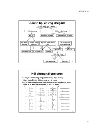 13/10/2016
8
Điện sinh lý tim (nhóm
IIa)
ICD (nhóm IIa)
+
Theo dõi
-
Quinidine
+
Theo dõi
-
Điện sinh lý tim
ICD (nhóm IIa)
+
Theo dõi
-
Xem xét điện sinh
lý tim (nhóm IIa)
ECG Brugada type 1 tự phát
Không tiền sử gia đìnhCó tiền sử gia đình
-
Hội chứng
Brugada
Nguyên nhân
ngoài tim
ICD (nhóm IIa)
Không triệu chứngCó triệu chứng
Đột tử
Điều trị hội chứng Brugada
15
Hội chứng tái cực sớm
 Tái cực sớm thường ở người trẻ không triệu chứng
 Nguy cơ xuất hiện rối loạn nhịp gây tử vong
 ECG: điểm J chênh lên > 1mm trong ít nhất 2 chuyển đạo vùng
dưới (II, III, aVF) hay vùng bên (I, aVL, V4 à V6)
16
 