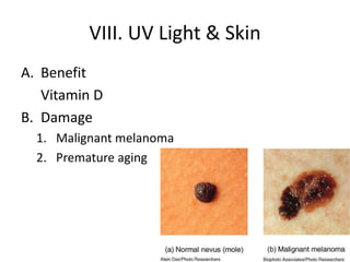 VIII. UV Light & Skin Benefit 	Vitamin D Damage Malignant melanoma Premature aging 