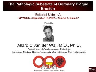 Editorial Slides (A)
VP Watch – September 18, 2002 – Volume 2, Issue 37
The Pathologic Substrate of Coronary Plaque
Erosion
Provided by:
Allard C van der Wal, M.D., Ph.D.
Department of Cardiovascular Pathology
Academic Medical Center, University of Amsterdam, The Netherlands.
 
