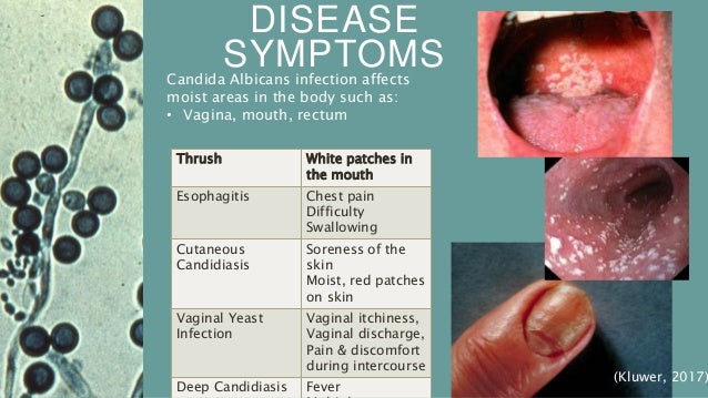 Microbial Cv On Candida Albicans