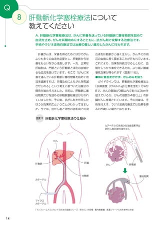 14
肝動脈がん
8 肝動脈化学塞栓療法について
教えてください
Q
A．肝動脈化学塞栓療法は、がんに栄養を送っている肝動脈に塞栓物質を詰めて
血流を止め、がんを兵糧攻めにするとともに、抗がん剤で攻撃する治療法です。
手術やラジオ波焼灼療法では治療の難しい進行したがんに行われます。
合液を肝動脈から強く注入し、がんやその周
辺の血管に長く留めることが行われています。
これにより、効果を持続させるとともに、血
管をしっかり塞栓できるため、より高い腫瘍
壊死効果が得られます（図表11右）。
●体に負担をかけず、がんのみを狙う
　ガイドラインでは、肝動脈化学塞栓療法は
「肝障害度（Child-Pugh分類を含む）がAか
Bで、がんの個数が3個以内であれば3cmを
超えているか、がんの個数が4個以上」の肝
臓がんに推奨されています。その対象は、手
術を行えず、ラジオ波焼灼療法では効果を得
るのが難しい場合となります。
　肝臓がんは、栄養を得るためにほかのがん
よりも多くの血液を必要とし、肝動脈から栄
養をもらいながら成長します。一方、正常な
肝細胞は、門脈という肝動脈とは別の血管か
らも血流を受けています。そこで「がんに栄
養を運んでいる肝動脈に塞栓物質を詰めて血
流を遮断すれば、兵糧攻めによりがんを死滅
させられる」という考えに基づいた治療法の
開発が進められました。当初は、肝動脈に塞
栓物質だけを詰める肝動脈塞栓療法が行われ
ていましたが、その後、抗がん剤を併用した
ほうが効果的だということがわかってきまし
た。今では、抗がん剤と油性の造影剤との混
図表11 肝動脈化学塞栓療法の仕組み
「インフォームドコンセントのための図説シリーズ　肝がん」沖田極・幕内雅敏編　医薬ジャーナル社を参考に作成
塞栓物質
肝動脈
マイクロ
カテーテル
がん
カテーテルの先端から油性造影剤と
抗がん剤の混合液を注入
肝臓
大動脈
カテーテル
 
