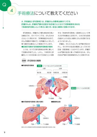 8
4
手術療法について教えてください
Q
A．手術療法（肝切除術）は、肝臓がんの標準治療の1つです。
肝臓がんは、肝臓を門脈の支配する区域ごとに分けて切除範囲を決める
「系統的肝切除」という考えに基づき、安全に確実に切除されます。
する「系統的肝切除術」(図表8上)という考
え方が手術療法に応用され、さまざまな技術
の進歩により安全に確実にがんを切除できる
ようになりました。
　肝臓は、中に入り込んでいる門脈が枝分か
れし、それぞれの血流の範囲によって8つの
区域（支配領域）に分かれています。肝臓が
んは門脈の血流に乗って転移するため、がん
のある門脈の支配領域を丸ごと切除すれば、
　肝切除術は、肝臓がんで最も根治性の高い
治療法です。ガイドラインでは、がんの大き
さはとくに問われず、「肝障害度がAかBで、
がんの個数が3個まで」の肝臓がんに対して、
第1選択の治療法として推奨されています。
●区域で切除する系統的肝切除術が基本
　じつは、かつての肝切除術は非常に難しく
て危険な手術でした。しかし、1985年に肝
臓をいくつかの区域に分けて区域ごとに切除
肝切除術の種類図表8
●系統的肝切除術
●非系統的肝切除術（部分切除） ●腫瘍核出術
東京大学大学院医学系研究科肝胆膵外科提供資料を参考に作成
クイノーによる8分割亜区域
ヒーリー＆シュロイによる4分割区域
右葉 左葉
内側区域後区域 外側区域前区域
がん
切除部分
肝静脈
門脈
1
2
3
4
5
6
7
8
門脈 門脈下大静脈 下大静脈
がん がん
2 2
3 3
8 8
7 7
6 65 5
44
下大静脈
切除部分切除部分
 
