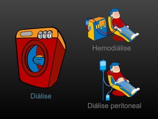 Diálise
Hemodiálise
Diálise peritoneal
 