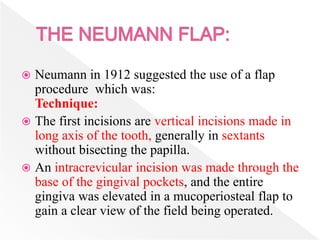  Neumann in 1912 suggested the use of a flap
procedure which was:
Technique:
 The first incisions are vertical incisions made in
long axis of the tooth, generally in sextants
without bisecting the papilla.
 An intracrevicular incision was made through the
base of the gingival pockets, and the entire
gingiva was elevated in a mucoperiosteal flap to
gain a clear view of the field being operated.
 
