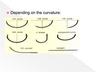  Depending on the curvature:
 