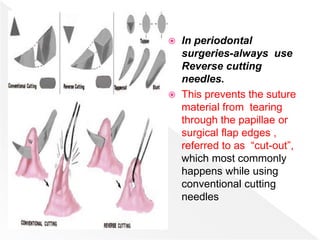  In periodontal
surgeries-always use
Reverse cutting
needles.
 This prevents the suture
material from tearing
through the papillae or
surgical flap edges ,
referred to as “cut-out”,
which most commonly
happens while using
conventional cutting
needles
 