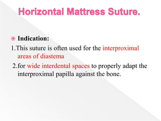  Indication:
1.This suture is often used for the interproximal
areas of diastema
2.for wide interdental spaces to properly adapt the
interproximal papilla against the bone.
 