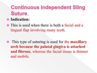  Indication:
 This is used when there is both a facial and a
lingual flap involving many teeth.
 This type of suturing is used for the maxillary
arch because the palatal gingiva is attached
and fibrous, whereas the facial tissue is thinner
and mobile.
 