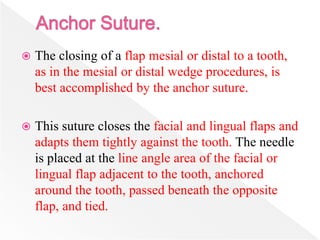  The closing of a flap mesial or distal to a tooth,
as in the mesial or distal wedge procedures, is
best accomplished by the anchor suture.
 This suture closes the facial and lingual flaps and
adapts them tightly against the tooth. The needle
is placed at the line angle area of the facial or
lingual flap adjacent to the tooth, anchored
around the tooth, passed beneath the opposite
flap, and tied.
 