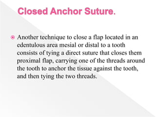  Another technique to close a flap located in an
edentulous area mesial or distal to a tooth
consists of tying a direct suture that closes them
proximal flap, carrying one of the threads around
the tooth to anchor the tissue against the tooth,
and then tying the two threads.
 