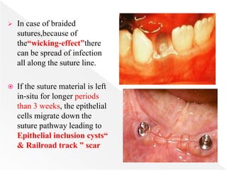  In case of braided
sutures,because of
the“wicking‐effect”there
can be spread of infection
all along the suture line.
 If the suture material is left
in‐situ for longer periods
than 3 weeks, the epithelial
cells migrate down the
suture pathway leading to
Epithelial inclusion cysts“
& Railroad track ” scar
 