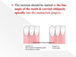  The incision should be started at the line
angle of the tooth & carried obliquely
apically into the unattached gingiva.
 