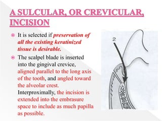  It is selected if preservation of
all the existing keratinized
tissue is desirable.
 The scalpel blade is inserted
into the gingival crevice,
aligned parallel to the long axis
of the tooth, and angled toward
the alveolar crest.
Interproximally, the incision is
extended into the embrasure
space to include as much papilla
as possible.
 