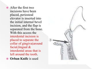  After the first two
incisions have been
placed, periosteal
elevator is inserted into
the initial internal bevel
incision, and the flap is
separated from the bone.
With this access the
interdental incision is
placed to separate the
collar of gingiva(around
facial,lingual &
interdental areas that is
left around the tooth.
 Orban Knife is used
 
