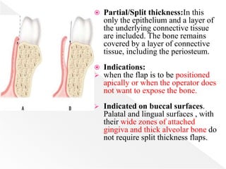  Partial/Split thickness:In this
only the epithelium and a layer of
the underlying connective tissue
are included. The bone remains
covered by a layer of connective
tissue, including the periosteum.
 Indications:
 when the flap is to be positioned
apically or when the operator does
not want to expose the bone.
 Indicated on buccal surfaces.
Palatal and lingual surfaces , with
their wide zones of attached
gingiva and thick alveolar bone do
not require split thickness flaps.
 