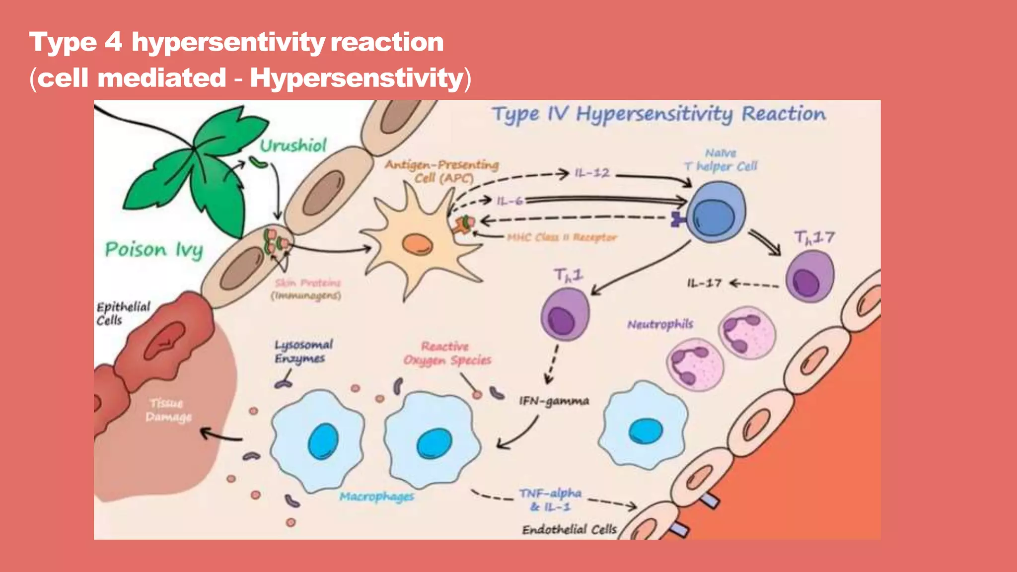 Type 4 hypersentivityreaction
(cell mediated - Hypersenstivity)
 