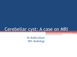 Cerebellar cyst: A case on MRI
Dr Rekha khare
MD. Radiology
 