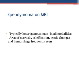 Cerebellar cyst a case on mri Slide 37