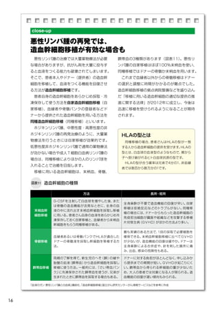 16
close-up
臍帯血の3種類があります（図表11）。悪性リ
ンパ腫の自家移植はほぼ100％末梢血を使い、
同種移植ではドナーの骨髄か末梢血を用います。
　これまで血縁者以外からの骨髄移植はドナー
の選択と調整に時間がかかるのが難点でした。
造血幹細胞移植の拠点病院整備などを盛り込ん
だ「移植に用いる造血幹細胞の適切な提供の推
進に関する法律」が2012年に成立し、今後は
迅速に移植を受けられるようになることが期待
されます。
　悪性リンパ腫の治療では大量薬物療法が必要
な場合がありますが、抗がん剤を大量に投与す
ると血液をつくる能力も破壊されてしまいます。
そこで、患者本人やドナー（提供者）の造血幹
細胞を移植して、血液をつくる機能を回復させ
る方法が造血幹細胞移植です。
　患者自身の造血幹細胞をあらかじめ採取・冷
凍保存して使う方法を自家造血幹細胞移植（自
家移植）、血縁者や骨髄バンクの登録者などド
ナーから提供された造血幹細胞を用いる方法を
同種造血幹細胞移植（同種移植）といいます。
　ホジキンリンパ腫、中悪性度・高悪性度の非
ホジキンリンパ腫の再発治療のように、大量薬
物療法を行うときには自家移植が効果的です。
低悪性度非ホジキンリンパ腫で通常の薬物療法
が効かない場合や成人Ｔ細胞白血病リンパ腫の
場合は、同種移植によりほかの人のリンパ球を
入れることで治癒を目指します。
　移植に用いる造血幹細胞は、末梢血、骨髄、
造血幹細胞の種類図表11
方法 長所・短所
末梢血幹
細胞移植
G-CSFを注射して白血球を増やした後、また
は骨髄の造血機能が活発なときに、全身の血
液の中に流れ出す末梢血幹細胞を採取し移植
に用いる。患者さん自身の血液をあらかじめ冷
凍保存しておく自家移植と、血縁者から末梢血
幹細胞をもらう同種移植がある。
全身麻酔が不要で造血機能の回復が早い。自家
移植は拒絶反応などのトラブルがない。同種移
植の場合には、ドナーからもらった造血幹細胞の
免疫担当細胞が臓器や組織などを攻撃する移植
片対宿主病（ＧＶＨＤ）がほかの方法より多い。
骨髄移植
血縁者あるいは骨髄バンクでHLAが適合した
ドナーの骨髄液を採取し幹細胞を移植する方
法。
最も実績のある方法で、１回の採取で必要細胞を
確保できる。末梢血幹細胞移植に比べてＧＶＨＤ
が少ないが、造血機能の回復は緩やか。ドナーは
全身麻酔による合併症や、針を刺した箇所に痛
み、出血、感染の危険性もある。
臍帯血移植
両親の了解を得て、新生児のへそ（臍）の緒や
胎盤の血液（臍帯血）から造血幹細胞を採取し
移植に使う方法。一般的には、「さい帯血バン
ク」に冷凍保存された臍帯血を使うが、兄弟が
生まれたときに臍帯血を採取する場合もある。
ドナーに対する負担がほとんどなく、申し込みか
ら提供までの期間が短い。ＧＶＨＤが起こりにく
い。臍帯血から得られる幹細胞の量が少ないた
め、大人の患者では対象になる人が限られる。造
血機能の回復が遅い傾向もみられる。
「血液のガン 悪性リンパ腫と白血病」講談社、「造血幹細胞移植」国立がん研究センターがん情報サービスなどを参考に作成
HLAの型とは
　同種移植の場合、患者さんはHLAの型が一致
する人から造血幹細胞の提供を受けます。HLAの
型とは、白血球の血液型のようなもので、親から
子へ受け継がれるヒト白血球抗原の型です。
　HLAの型が合う確率は兄弟で4分の1、非血縁
者では数百から数万分の1です。
悪性リンパ腫の再発では、
造血幹細胞移植が有効な場合も
 
