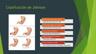 Johnson Classification System Anatomía y fisiología gástrica y duodenal | PPTX