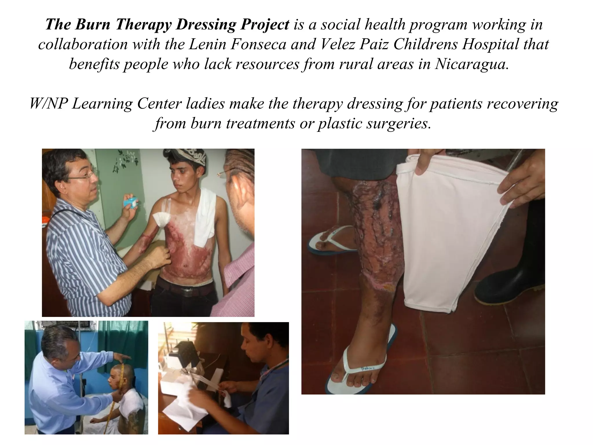 The Burn Therapy Dressing Project is a social health program working in
collaboration with the Lenin Fonseca and Velez Paiz Childrens Hospital that
benefits people who lack resources from rural areas in Nicaragua.
W/NP Learning Center ladies make the therapy dressing for patients recovering
from burn treatments or plastic surgeries.

 