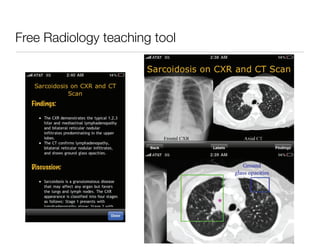 Free Radiology teaching tool
 