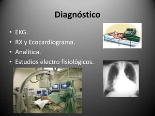 DiagnósticoEKG.RX y Ecocardiograma.Analítica.Estudios electro fisiológicos.