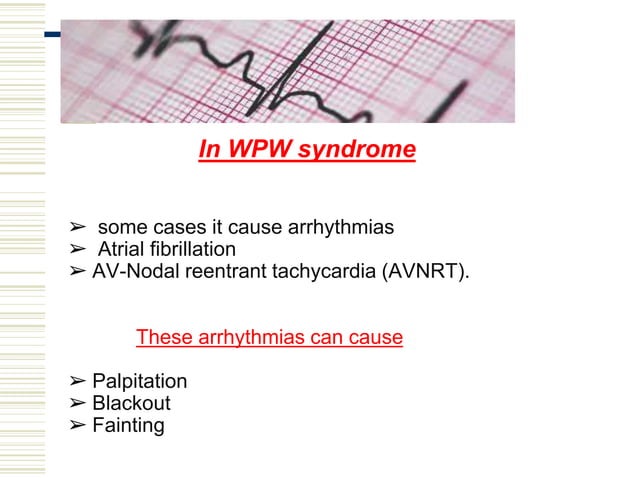 Wolff parkinson white syndrome | PPT