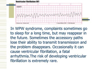 Wpw Risks Wolff parkinson white syndrome | PPTX