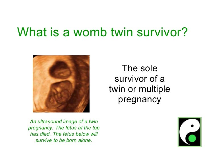 Pregnancy signs of twin Early Signs