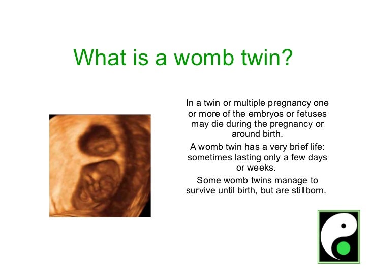 Womb Twin Survivors (1) Signs of a twin