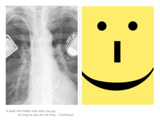 It does not matter how slow you go..
         so long as you do not stop. - Confucius
 