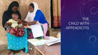 THE
CHILD WITH
APPENDICITIS
 