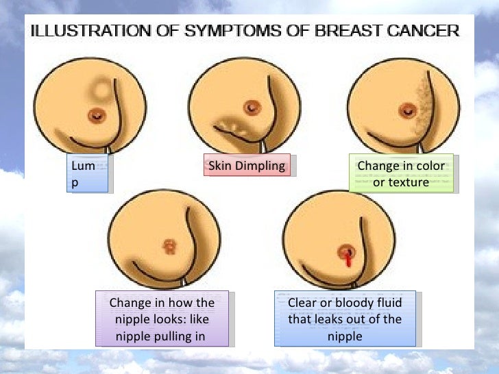 Women's cancers navs 2011