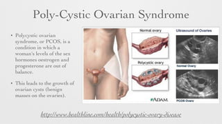 Poly-Cystic Ovarian Syndrome
• Polycystic ovarian
syndrome, or PCOS, is a
condition in which a
woman's levels of the sex
hormones oestrogen and
progesterone are out of
balance.
• This leads to the growth of
ovarian cysts (benign
masses on the ovaries).
http://www.healthline.com/health/polycystic-ovary-disease
 