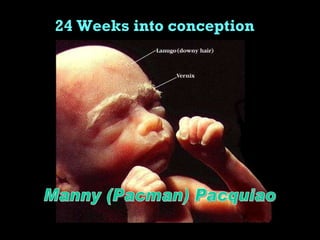 24 Weeks into conception Manny (Pacman) Pacquiao 