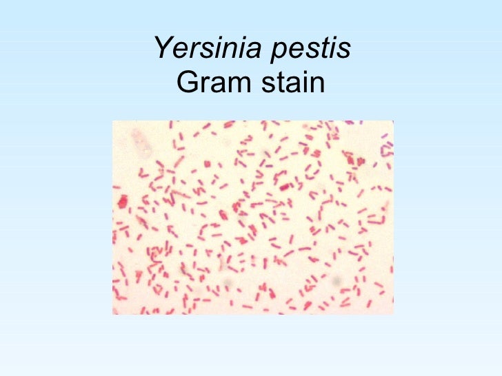 microbiological diagnosis