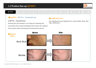 1.1 Product line-up QUEEN

       QUEEN              COSJET TR             COSJET SR           COSJET VR    COSJET AR             PDT 608            PDT D662              oaze


        ■ QUEEN – RF CO ₂ Fractional Laser
                                                                                 ■ Application Area
       As RF CO ₂ Fractional Laser,                                              Scar, Superficial Lesions, Epidermal Nevi, Actinic Chelitis, Warts, Skin
       Fractional laser skin treatment is an exciting new technology that        Tags, and Keratoses.

       successfully corrects many dermatological and cosmetic skin conditions,
       with increased comfort and minimal post-treatment pain and care


                                                           Before                                 After
       ■ Clinical
         Photos


                         Acne Scar




                             Wrinkle



Copyrights© WONtechnology Co., Ltd. All Rights Reserved.
 